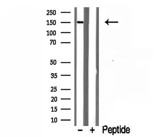 RPGRIP1L Antibody