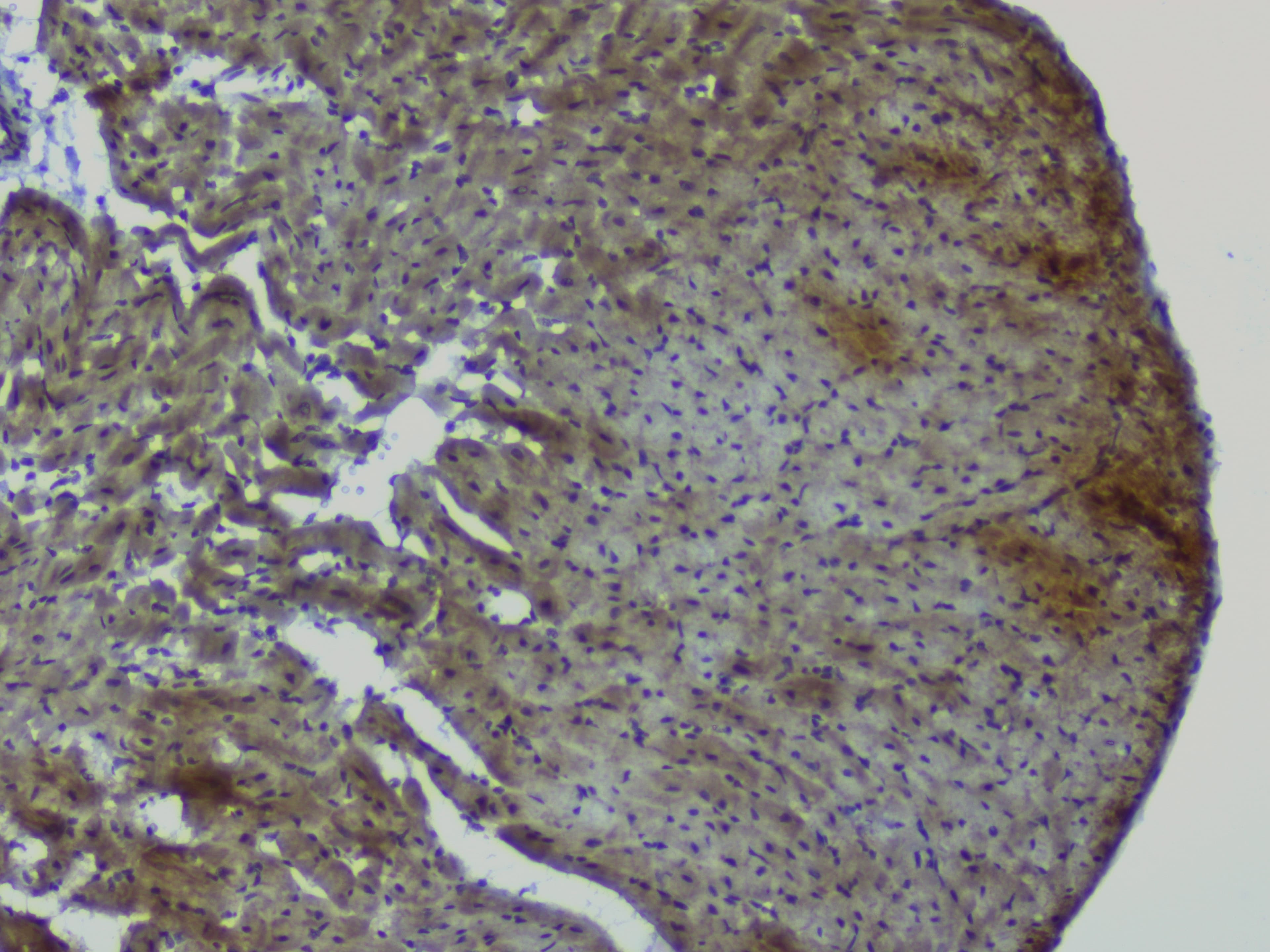 NRF1 / NRF-1 Antibody