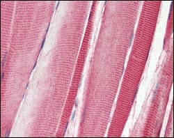 DDR2 Antibody (clone 3B11E4)