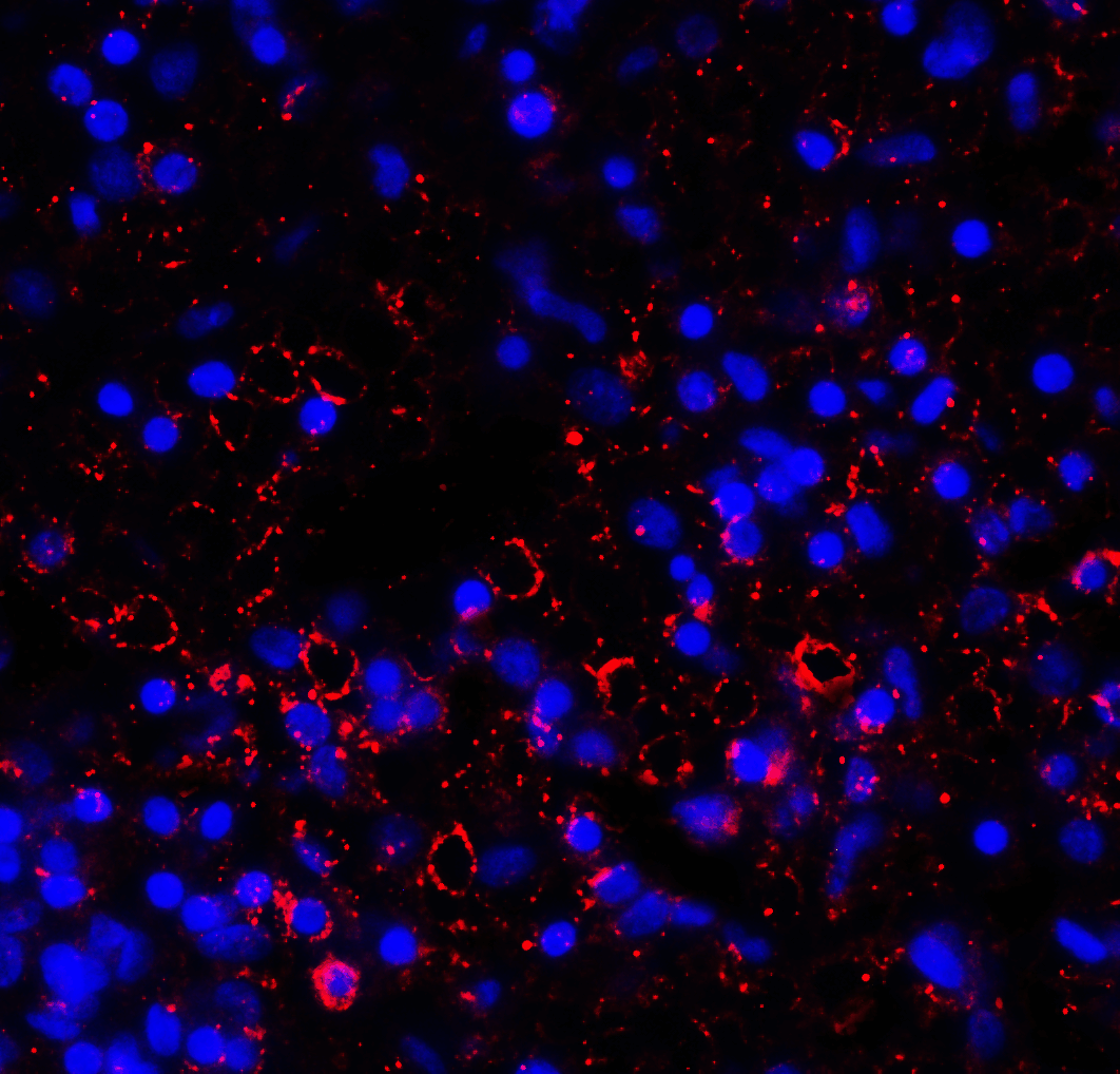 Monoclonal Mouse anti-Human LAG3 Antibody (clone 2G8, IHC, IF, WB)