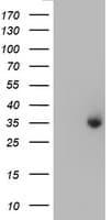 ERCC1 Antibody (clone OTI5E6)