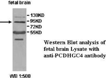PCDHGC4 Antibody (aa380-642)