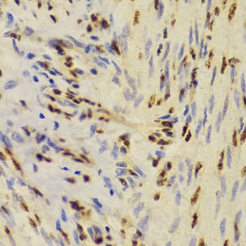 XRCC5 / Ku80 Antibody