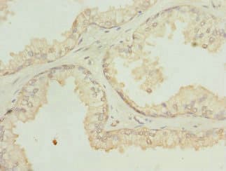 Polyclonal Rabbit anti-Human SH3GLB2 / Endophilin-B2 Antibody (IHC)