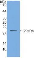 AQP4 / Aquaporin 4 Antibody (aa177-304)
