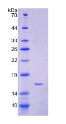 Human HAMP / Hepcidin Protein (Recombinant His, N-Terminal)