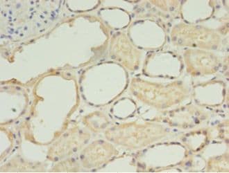 Trimethylguanosine Synthase 1 Antibody (aa713-853, Biotin)