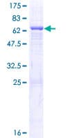 Human QTRT1 Protein (Recombinant GST)