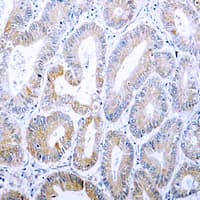 KRT18 / CK18 / Cytokeratin 18 Antibody (phospho-Ser33)