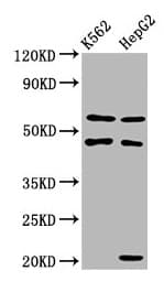 GATB / PET112 Antibody