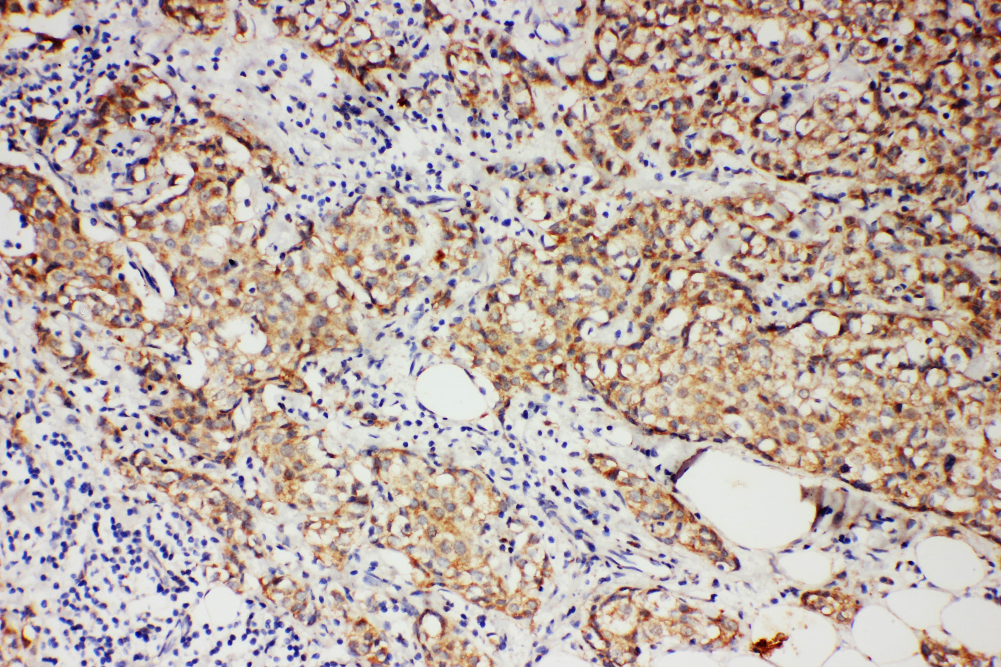 PR / Progesterone Receptor Antibody (aa595-933)