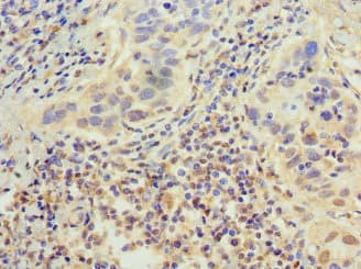 EP300 / p300 Antibody