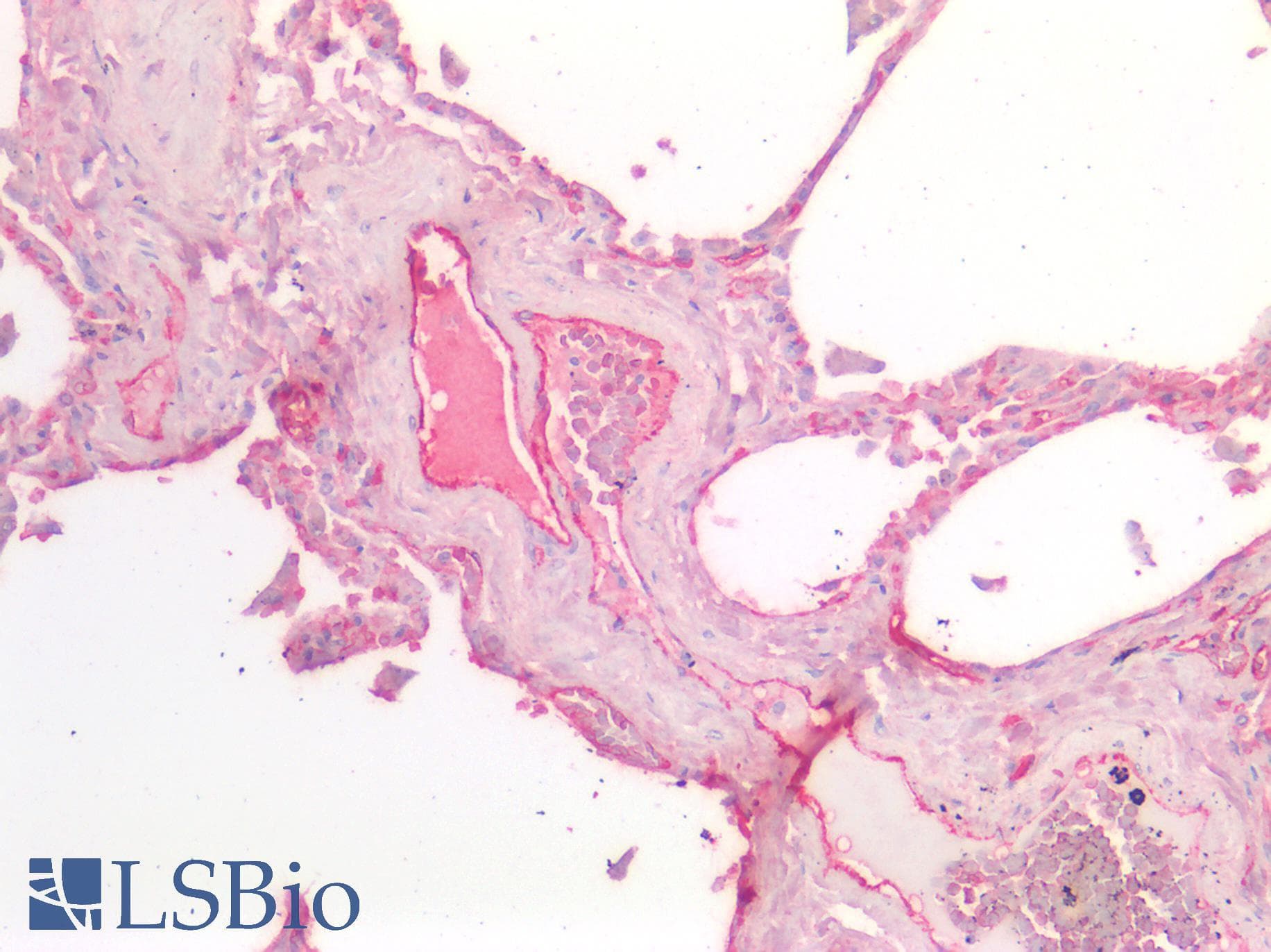 IHC-plus™ VWF / Von Willebrand Factor Antibody