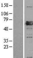 PRPF31 Protein (Over-Expression Lysate Myc-DDK (Flag))