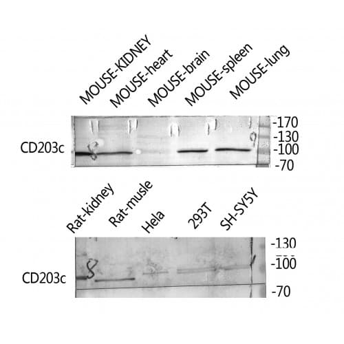 ENPP3 / CD203c Antibody (270-320 aa, Internal)