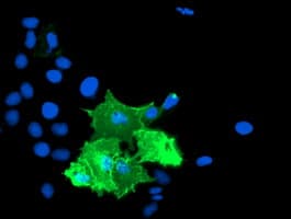 TULP3 Antibody (clone OTI6H4)