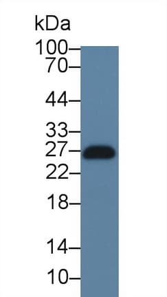 LAT Antibody (aa33-227)