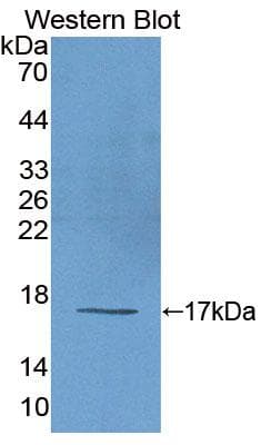 LGTN / EIF2D Antibody (aa1-117, PE)