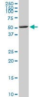 IHC-plus™ CDS1 Antibody (clone 2D10)