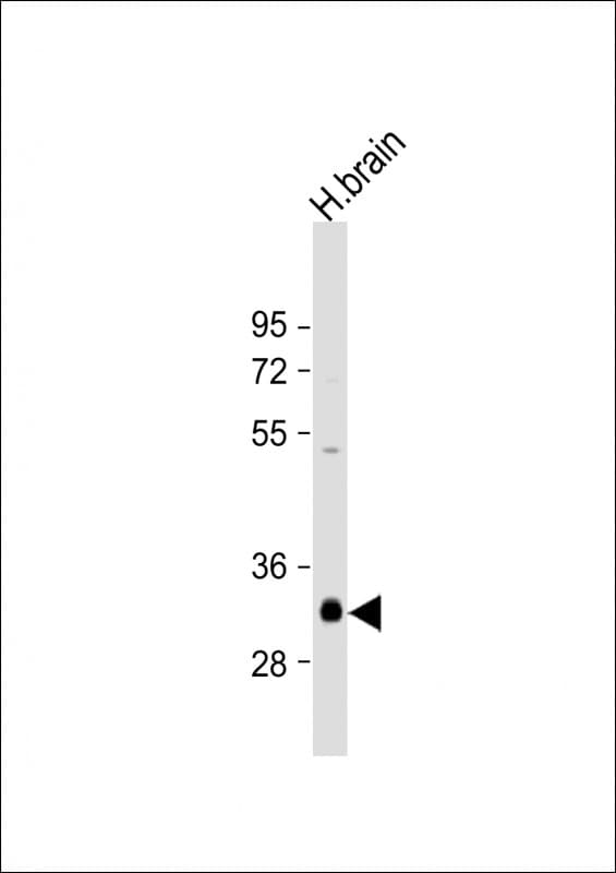 NMNAT1 / NMNAT Antibody (aa200-232)