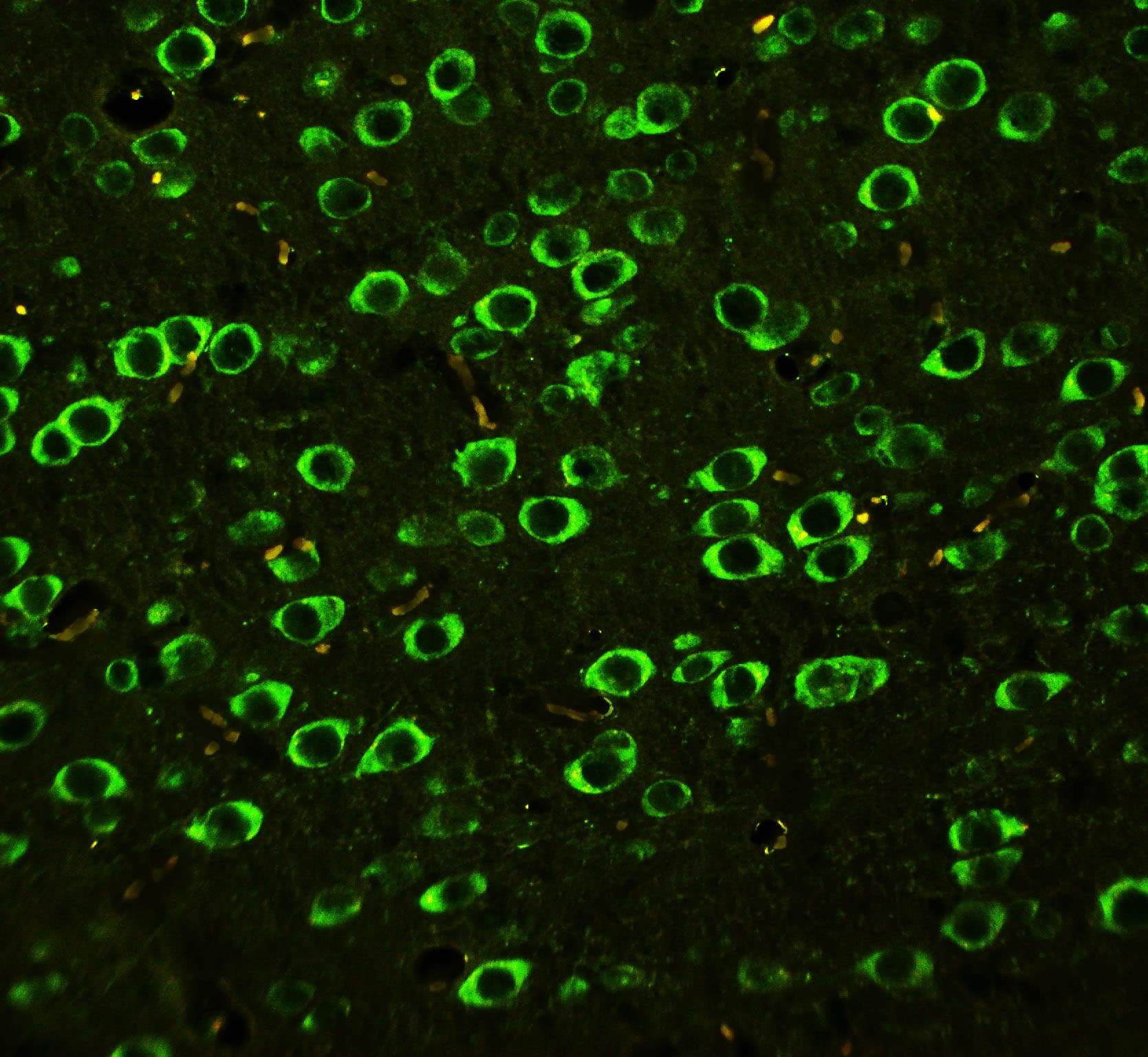 Polyclonal Rabbit anti-Human ABI1 / SSH3BP1 Antibody (aa483-494, IHC, WB)