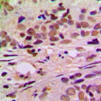 CCNL1 / Cyclin L1 Antibody (C-Terminus)