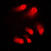 IHC-plus™ CREBBP / CREB Binding Protein Antibody (C-Terminus)