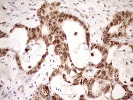 Monoclonal Mouse anti-Human WTAP Antibody (clone OTI12G6, Carrier-free, aa2-106, IHC, WB)