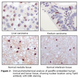 Monoclonal Mouse anti-Human KAT5 / TIP60 Antibody (clone 3F9G7, IHC, WB)