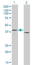 Monoclonal Mouse anti-Human F3 / CD142 / Tissue factor Antibody (clone 4G4, WB)