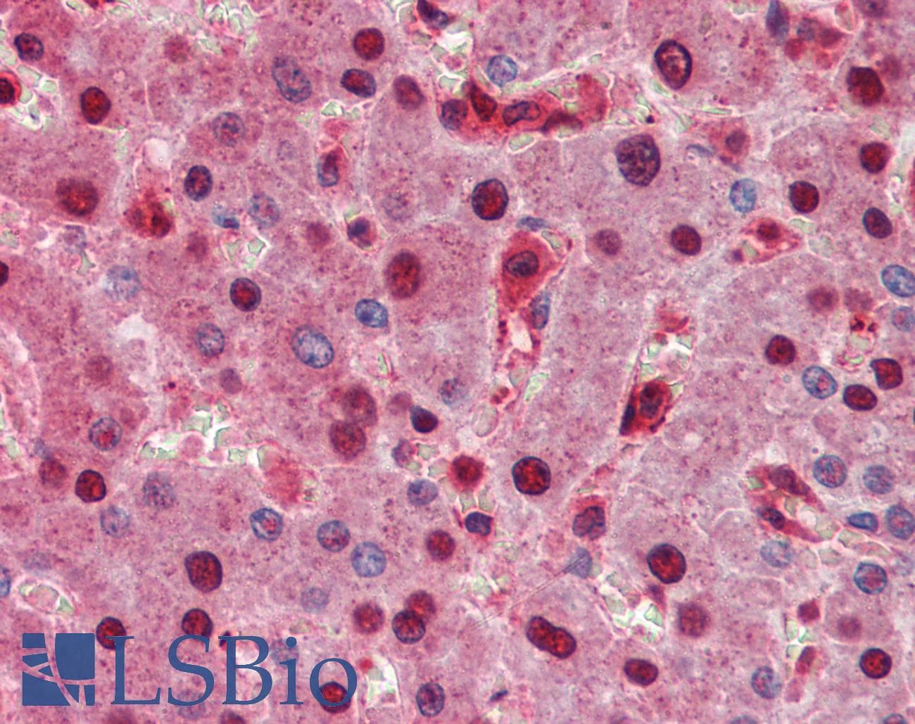 IHC-plus™ Polyclonal Rabbit anti-Human SPRED1 Antibody (IHC, IF, WB)