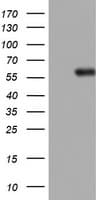 TOP2A / Topoisomerase II Alpha Antibody (aa1100-1531, clone OTI1D5)
