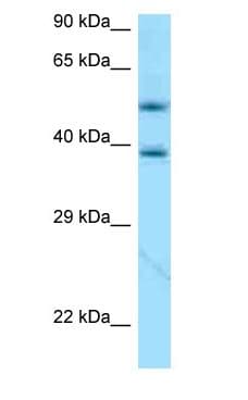 Polyclonal Rabbit anti-Human APOE / Apolipoprotein E Antibody (aa81-130, IHC, WB)