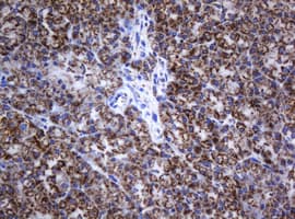 Monoclonal Mouse anti-Human NDUFB10 Antibody (clone OTI2G1, IHC, WB)