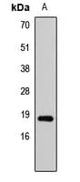 Polyclonal Rabbit anti-Human SAP18 Antibody (IHC, WB)