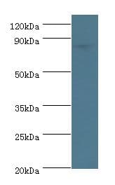 ATRIP Antibody (aa1-260)