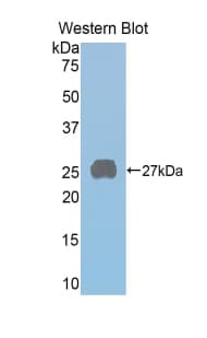 PRLR / Prolactin Receptor Antibody (aa20-229)