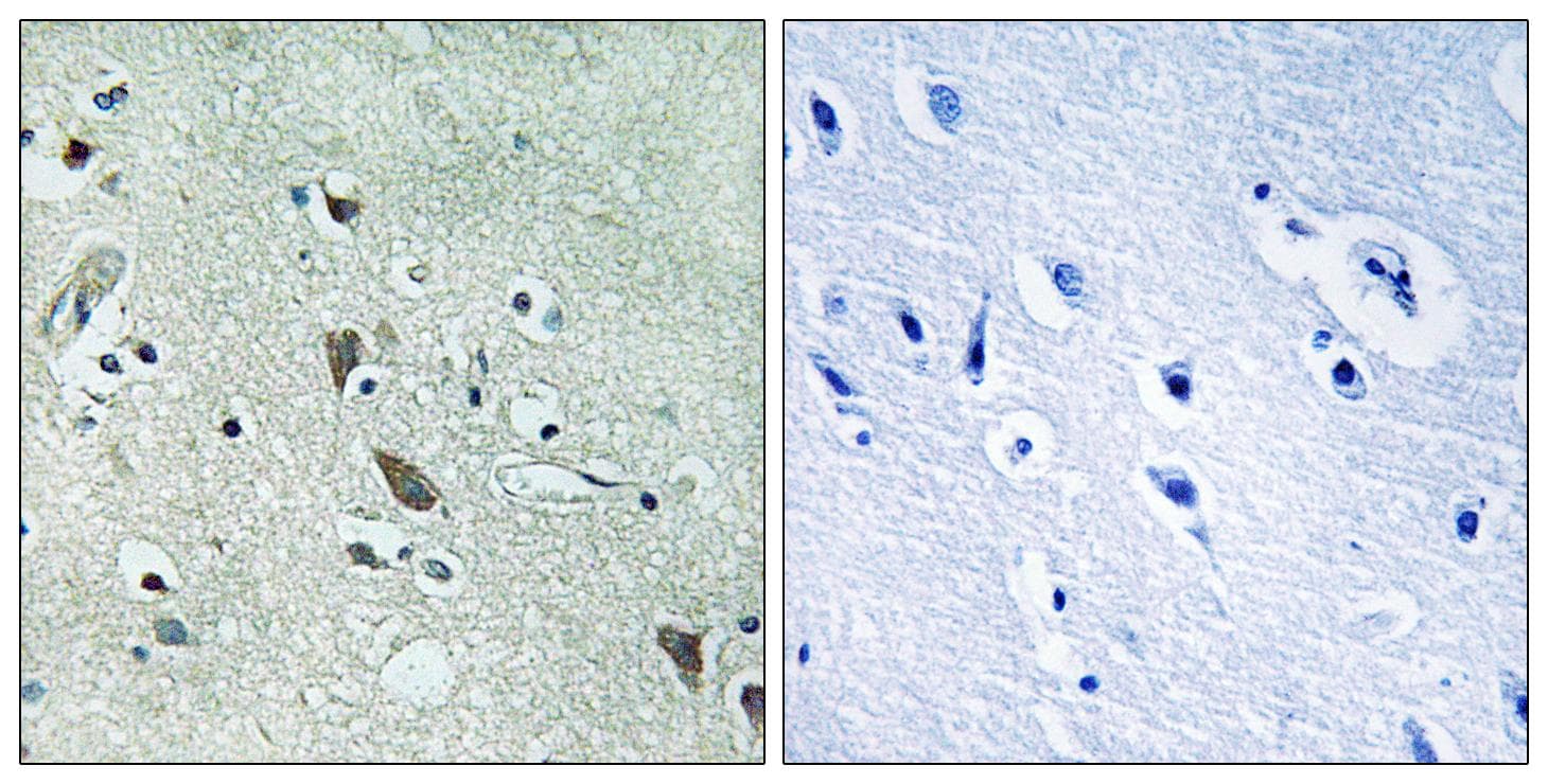 HTRA2 / OMI Antibody (Ab-212)