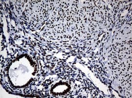 NBN / Nibrin Antibody (clone OTI3A9)