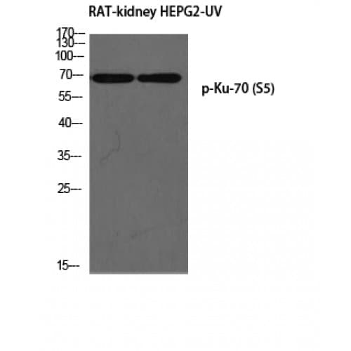 Polyclonal Rabbit anti-Human XRCC6 / Ku70 Antibody (1-80 aa, IHC, WB)