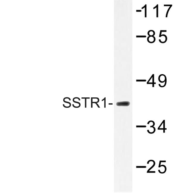 SSTR1 Antibody (Asn48)