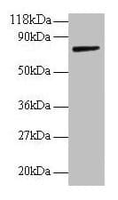 IHC-plus™ Polyclonal Rabbit anti-Human ANXA6/Annexin A6/Annexin VI Antibody (aa2-245, IHC, WB)