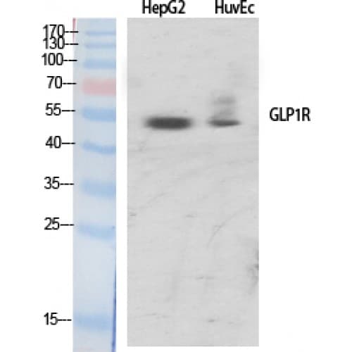 GLP1R / GLP-1 Receptor Antibody (80-160 aa, Internal)