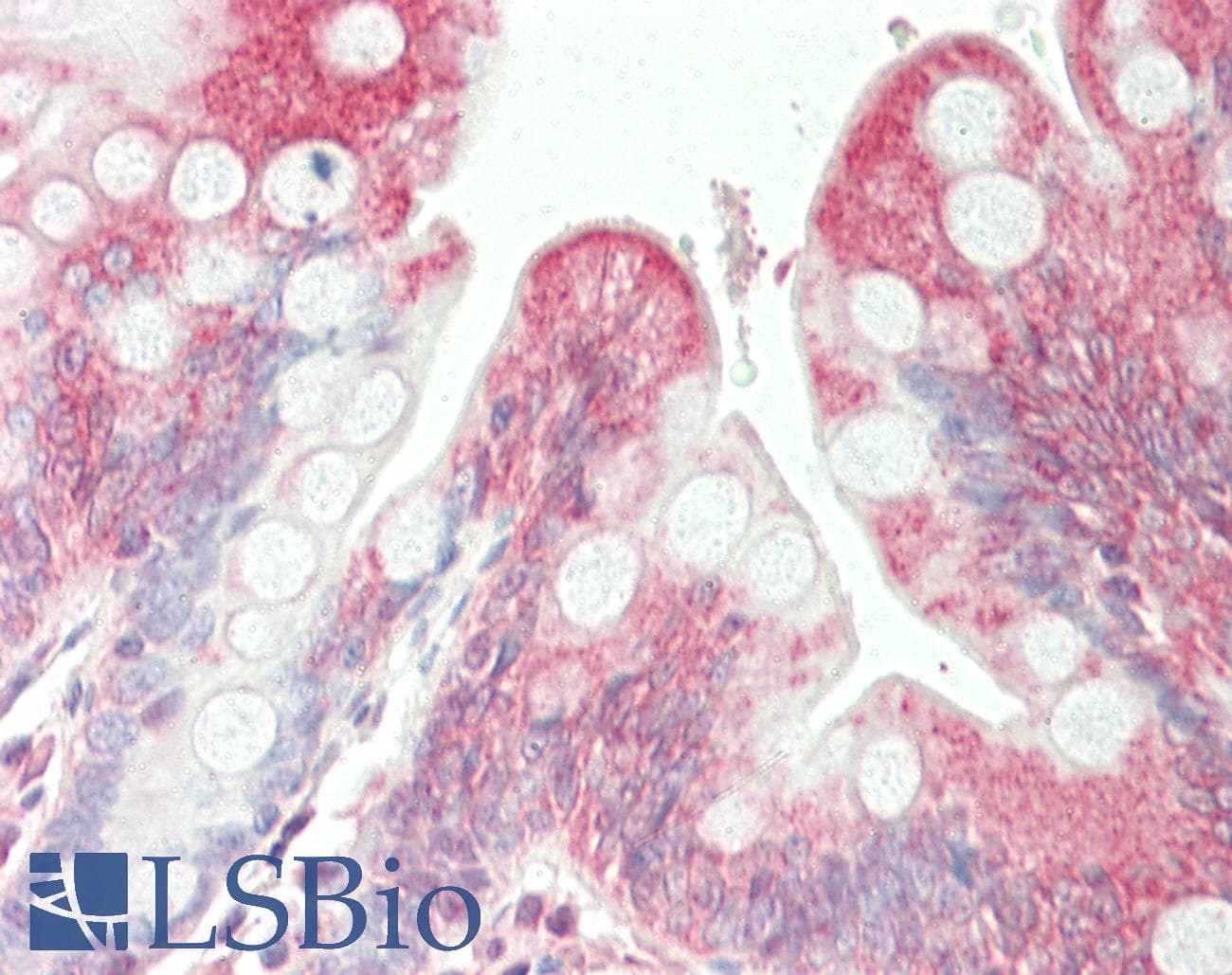 IHC-plus™ Polyclonal Rabbit anti-Human SGPL1 Antibody (aa72-101, IHC, WB)