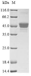 Candida albicans PRA1 Protein (Recombinant 6His, N-terminus)