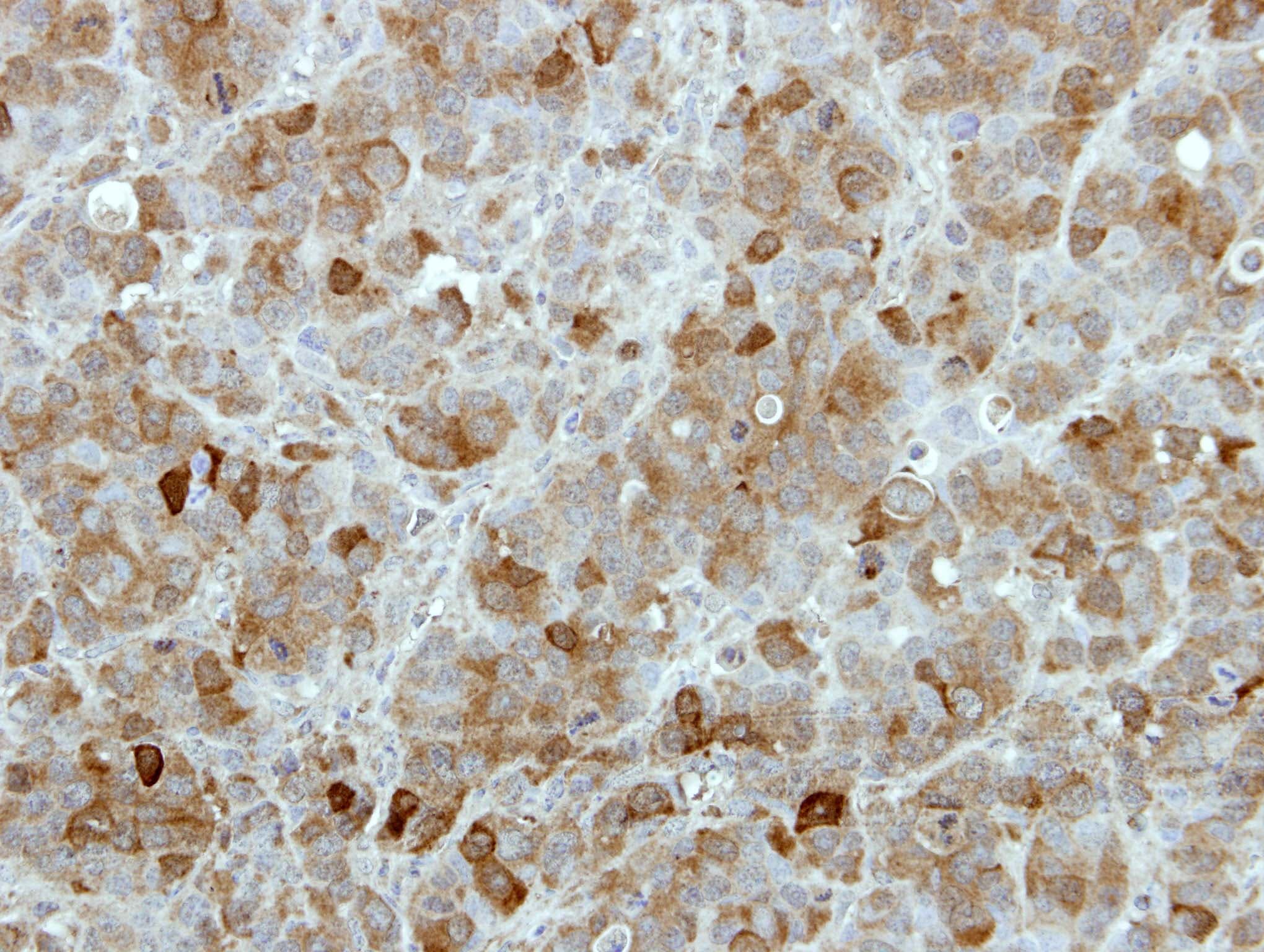 TBCK / TBCKL Antibody (aa457-694)