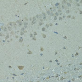 Polyclonal Rabbit anti-Human IVNS1ABP / NS1-BP Antibody (IHC)