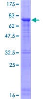 Human PAFAH1B1 / LIS1 Protein (Recombinant GST)