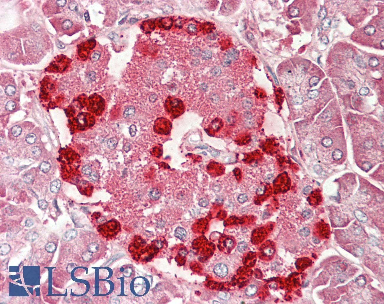 IHC-plus™ Polyclonal Goat anti-Human TSPYL2 / DENTT Antibody (aa441-454, IHC, WB)