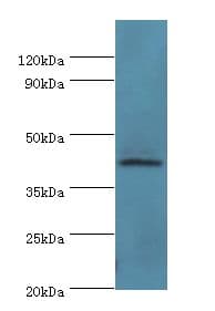 PARL / PSARL Antibody (aa1-170)